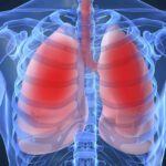 Is Butane Harmful to Lungs?